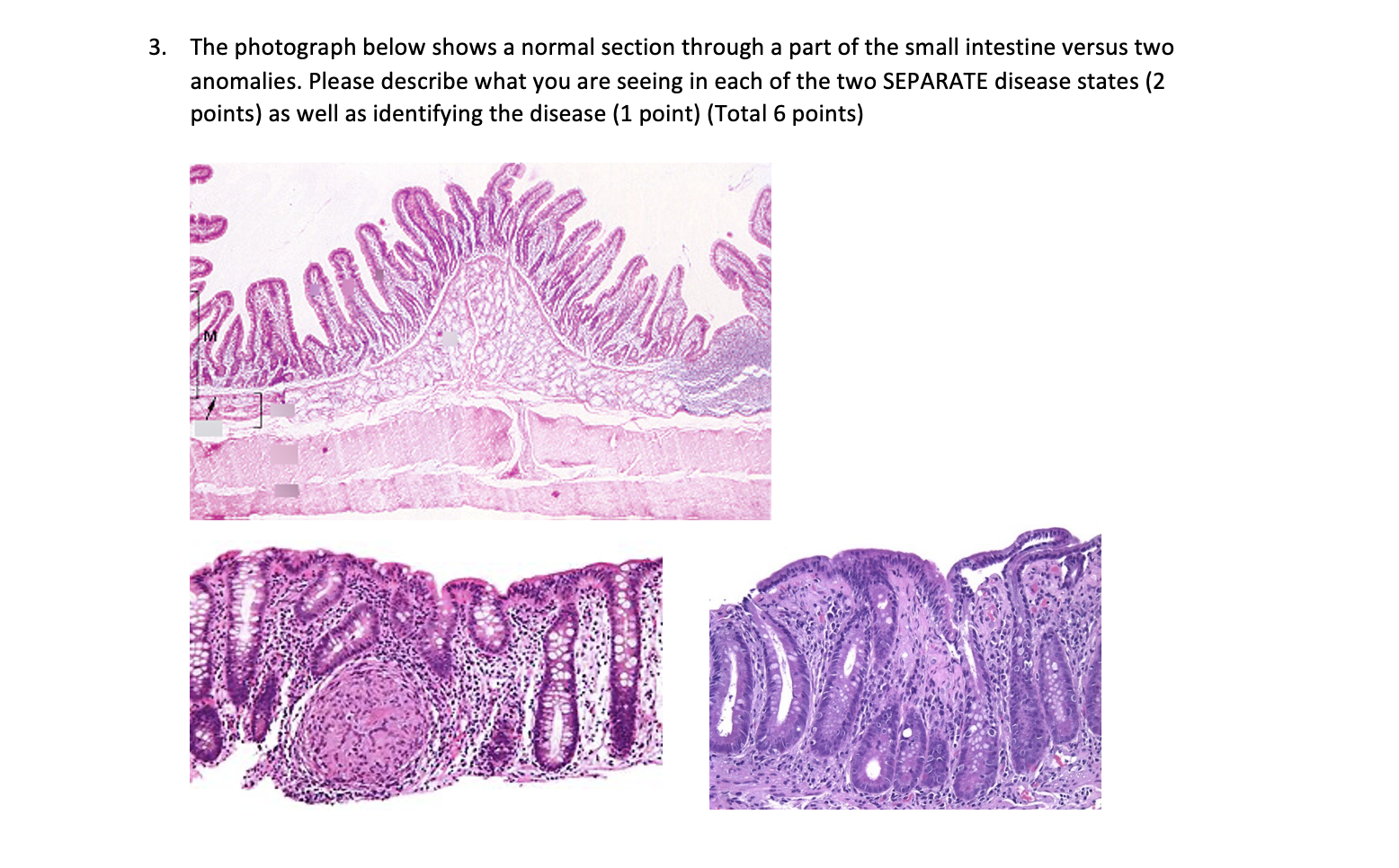 Solved The photograph below shows a normal section through a | Chegg.com