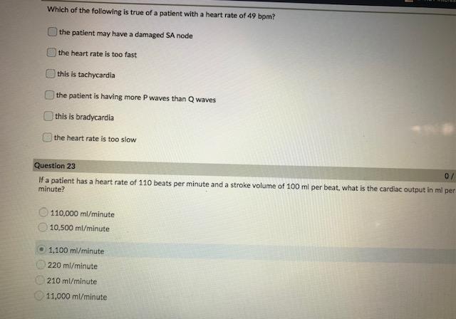 Solved Which of the following would increase cardiac output? | Chegg.com