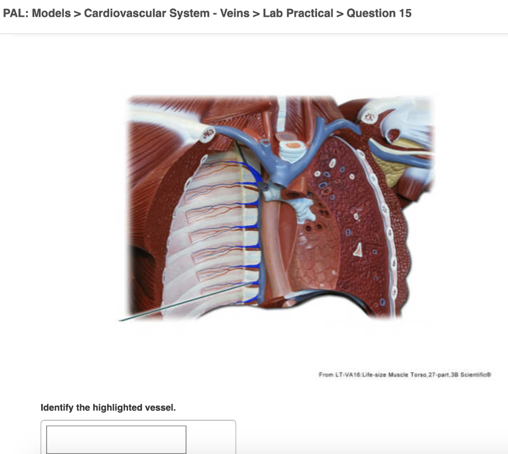 Solved PAL Models > Cardiovascular System Arteries > Lab