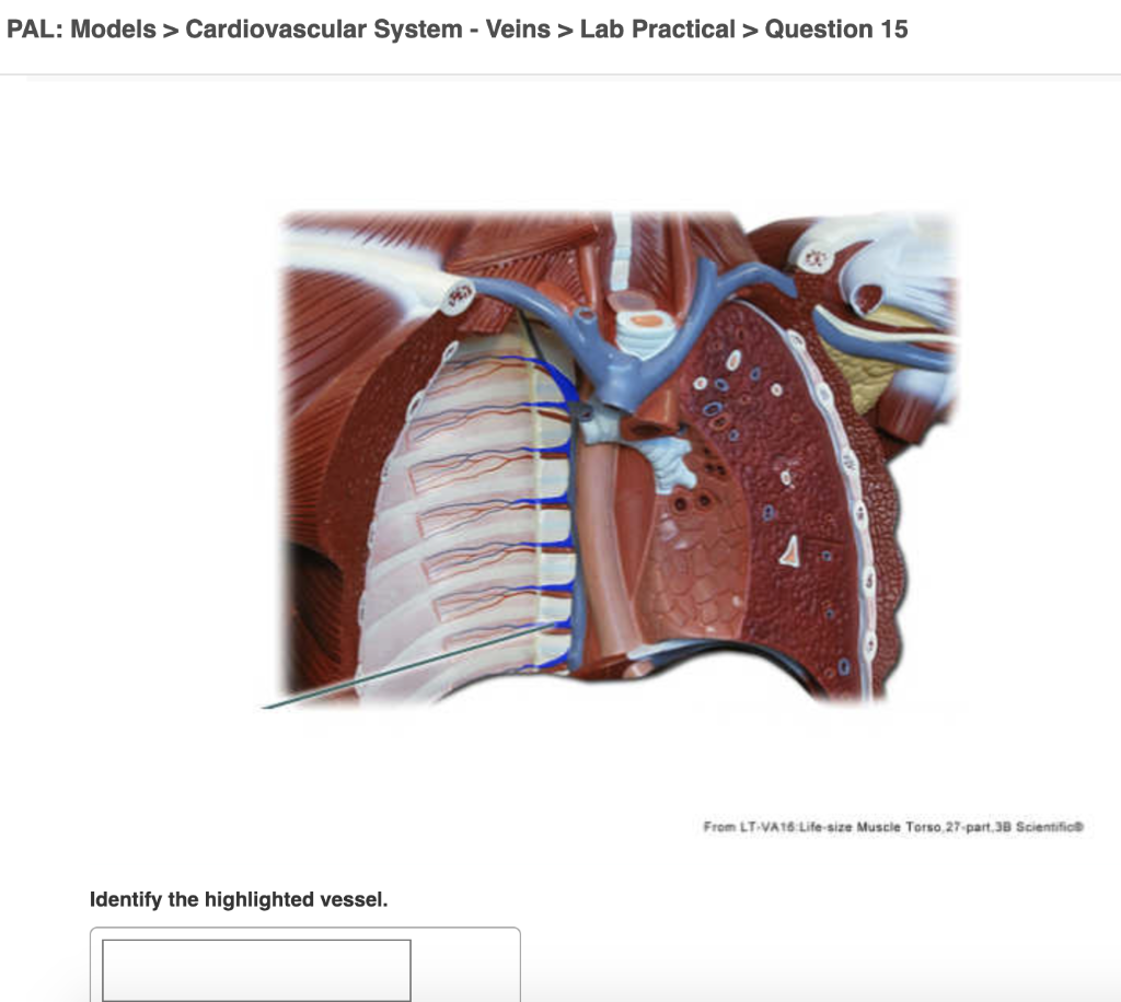 Solved PAL: Models > Cardiovascular System - Arteries > Lab | Chegg.com