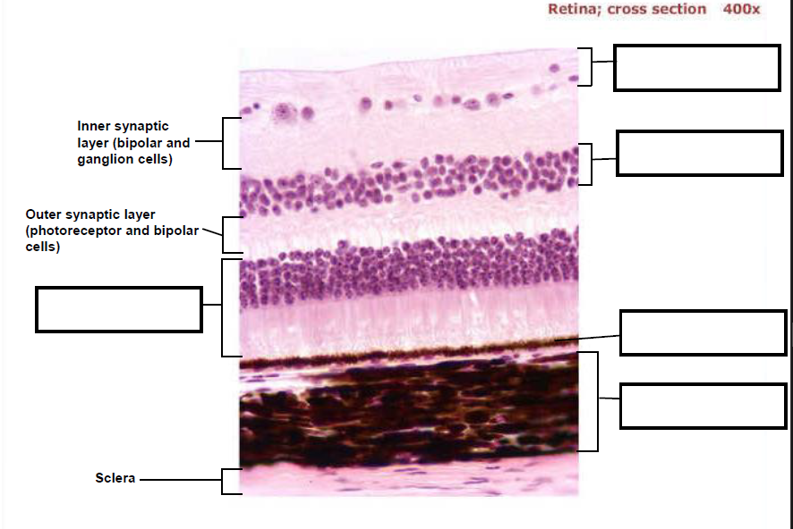 Solved Retina; cross section 400x } Inner synaptic layer | Chegg.com