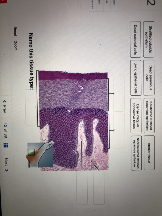 Solved Correctly Identify This Tissue Type And Then Label 