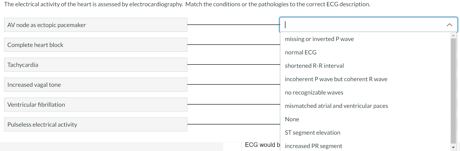 Solved The electrical activity of the heart is assessed by | Chegg.com