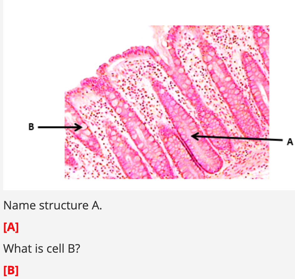 Solved Name Structure A. [A] What Is Cell B? [B] | Chegg.com