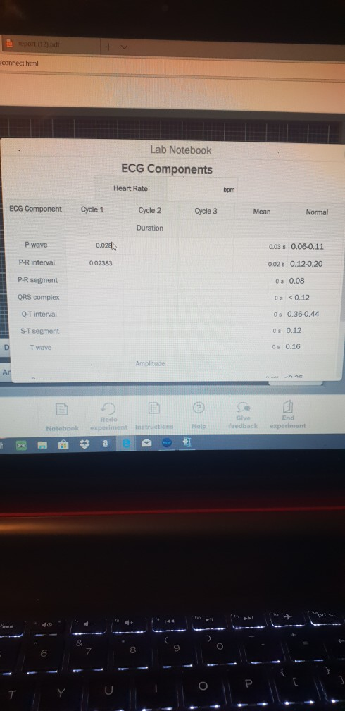 Solved: Eport (12) Connect.html Lab Notebook ECG Component ...