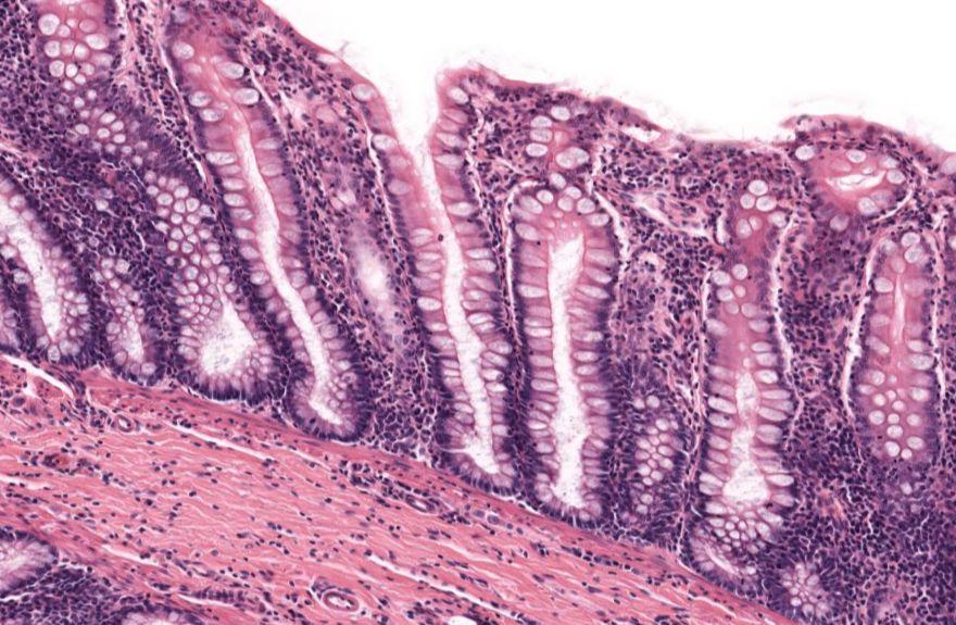 Solved What Type Of Gland Is This?simpleacinarsimple 