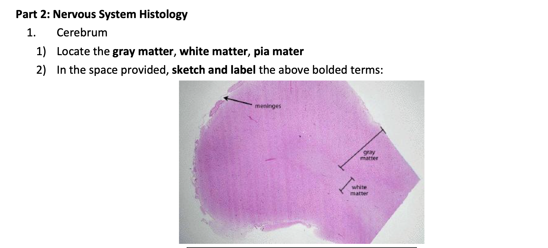 arachnoid mater histology