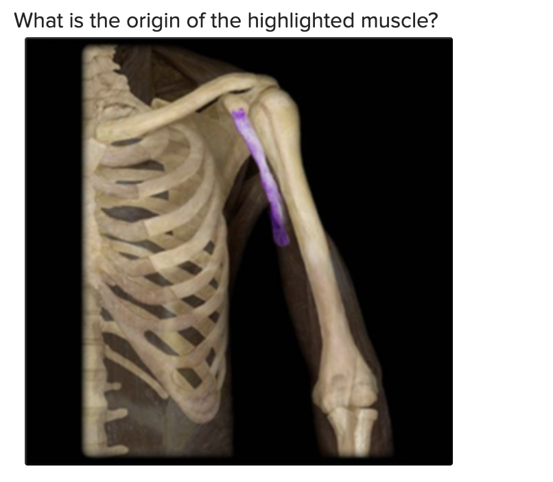 Coronoid process of scapula
