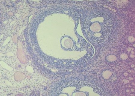 Solved This is a microscope slide of a mature (Graafian) | Chegg.com