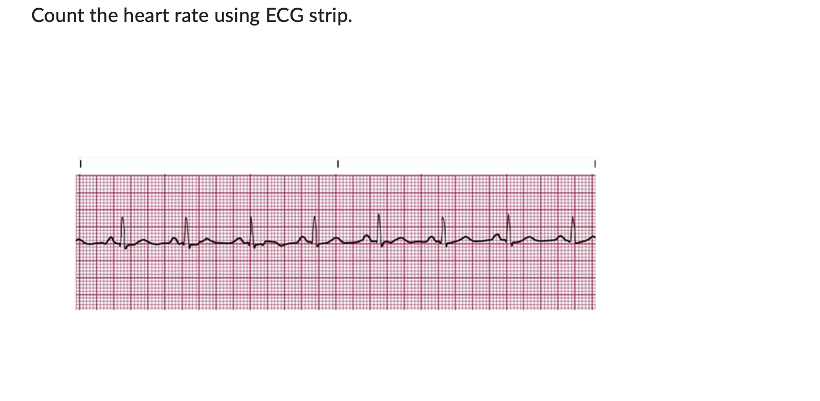 Solved Count the heart rate using ECG strip. | Chegg.com