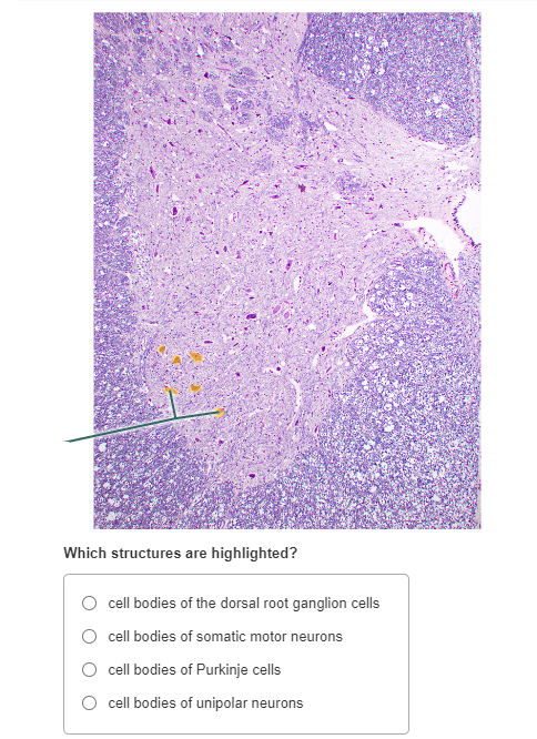 Solved Which structures are highlighted? cell bodies of the | Chegg.com