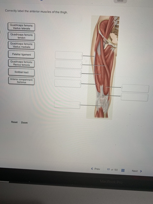 Solved Correctly label the anterior muscles of the thigh.