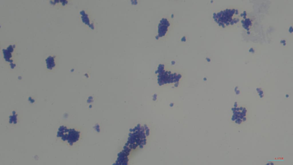 Staphylococcus aureus light microscopy. Morphology of Staphylococcus aureus  under the microscope. Micrograph of S.aureus, Gram stain. Gram-stained  smear from culture.