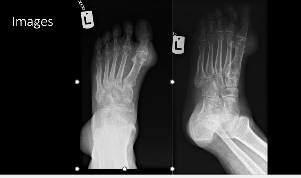 Solved WHAT ARE THE FINDINGS AND IMPRESSIONS FOR THIS XRAY. | Chegg.com