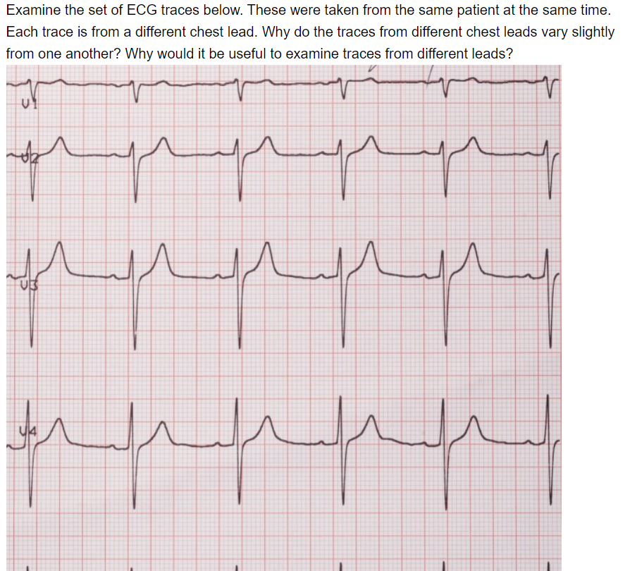 Solved The heart sounds are commonly described as 