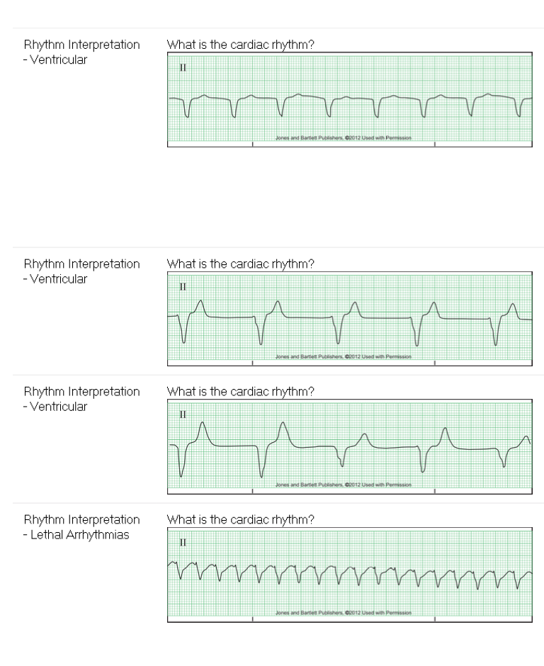 Subject Question F What is the cardiac rhythm? Rhythm | Chegg.com