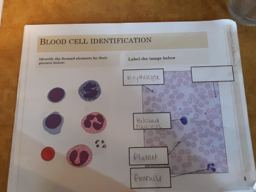 solved-blood-cell-identification-identify-the-formed-elem-chegg