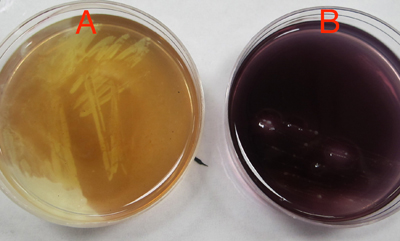 Solved Two Different Bacterial Samples, A And B, Were | Chegg.com