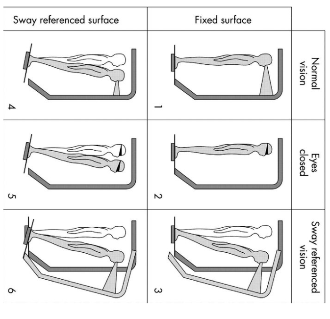 Solved Which of the conditions in the sensory organization | Chegg.com