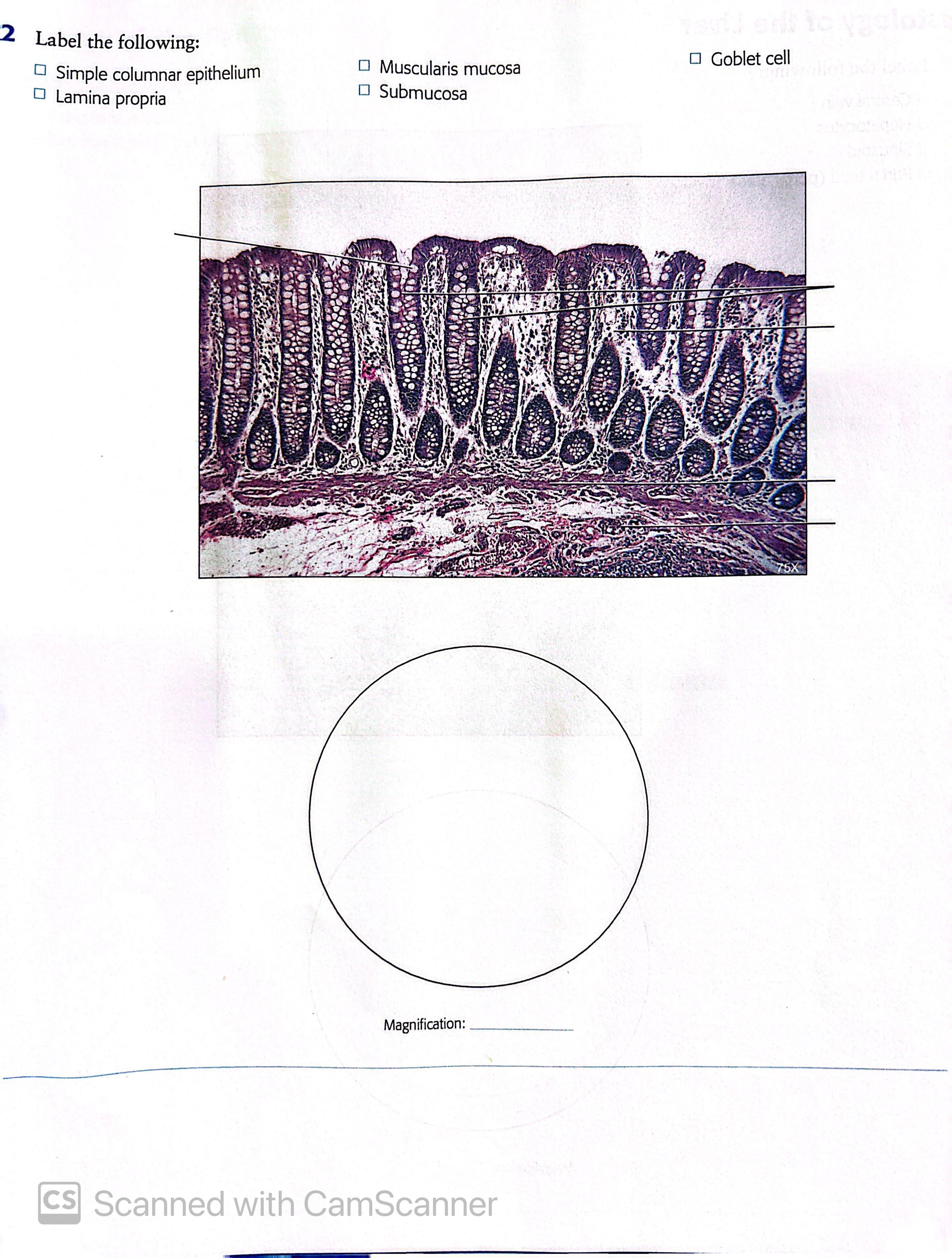 Solved 2 Label The Following Simple Columnar Epithelium 6300