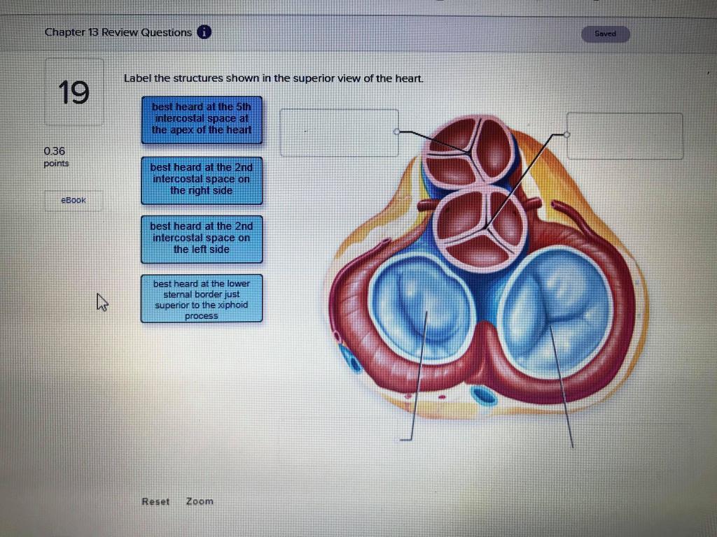 Solved Chapter 13 Review Questions 0 Saved Label the | Chegg.com