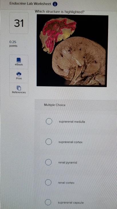 Solved: Endocrine Lab Worksheet I Which Structure Is Highl... | Chegg.com