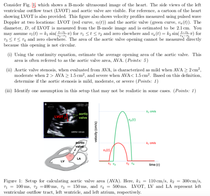 Consider Fig. 1), which shows a B-mode ultrasound image of the heart. The side views of the left ventricular out flow tract (