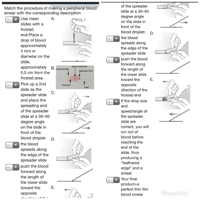 Solved Match the procedure of making a peripheral blood | Chegg.com