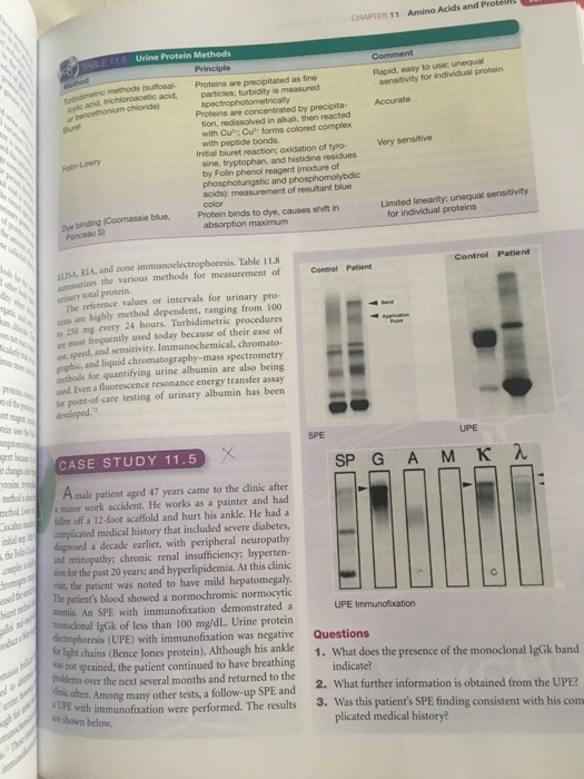 Solved CHAPTER 11 Amino Acids and Proteins Urine Protein