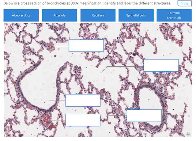 Solved Below Is A Cross Section Of Bronchioles At 300x 