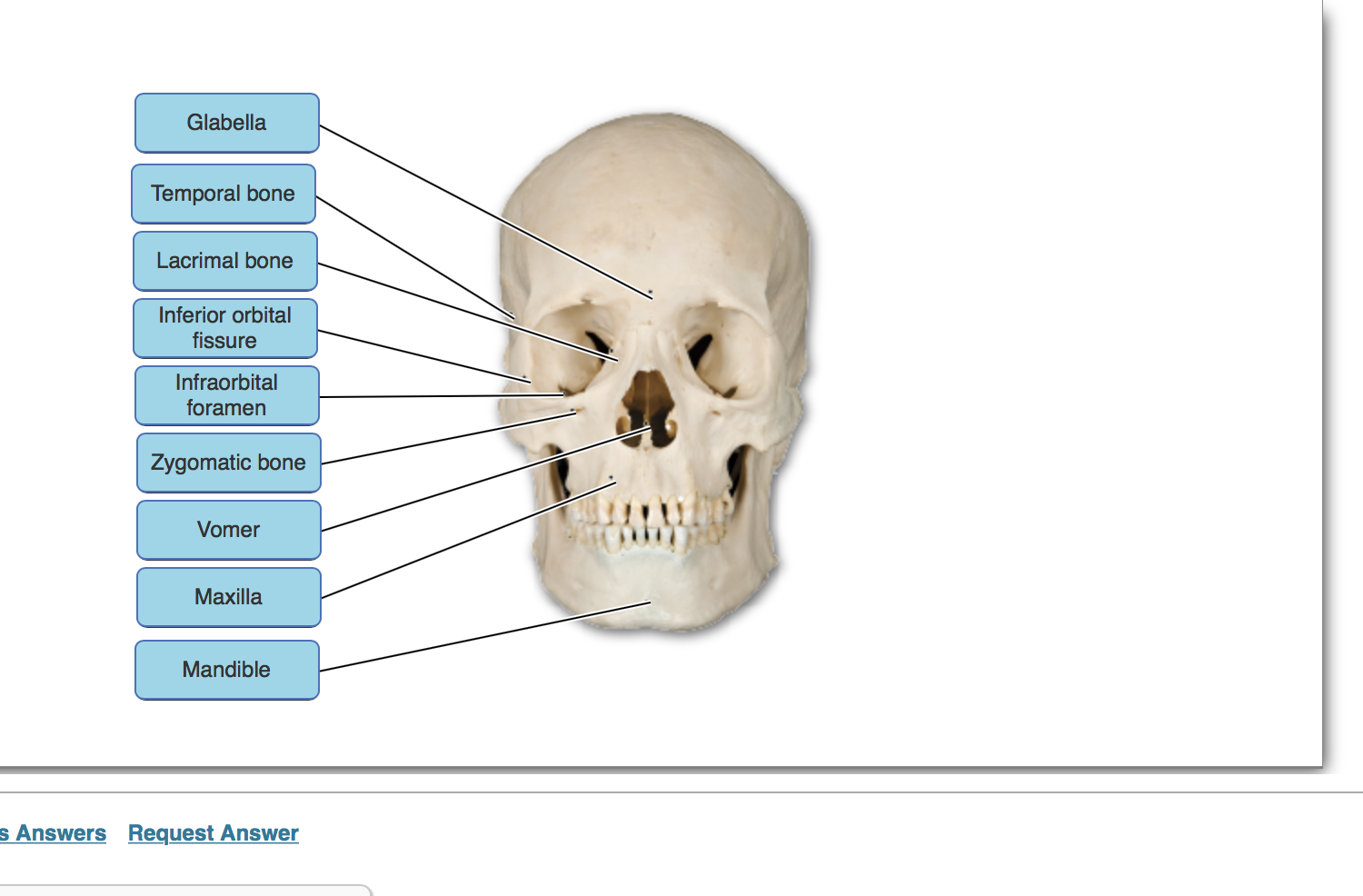 Solved Glabella Temporal bone Lacrimal bone Inferior orbital