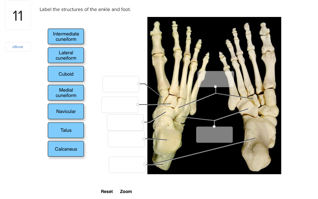 Solved Label The Structures Of The Ankle And Foot. 11 