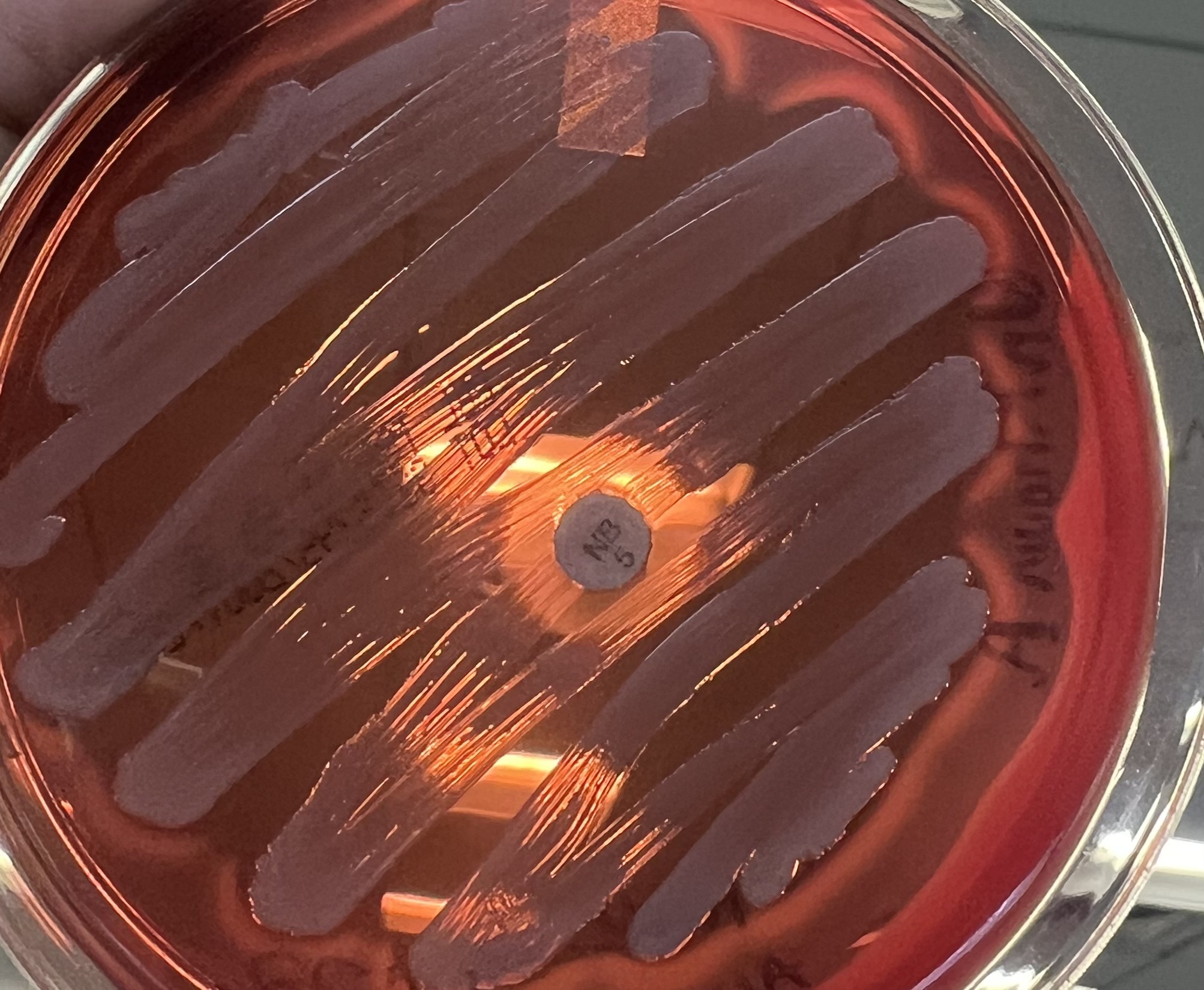 Solved Beta, Alpha, or Gamma Hemolysis? | Chegg.com