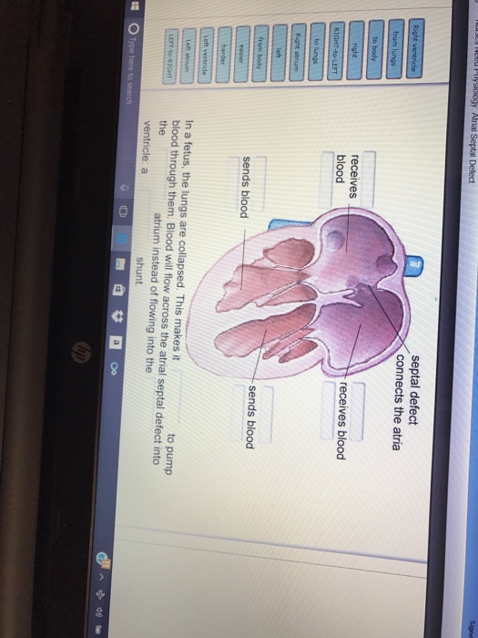 Solved In a fetus, the lungs are collapsed. This makes it