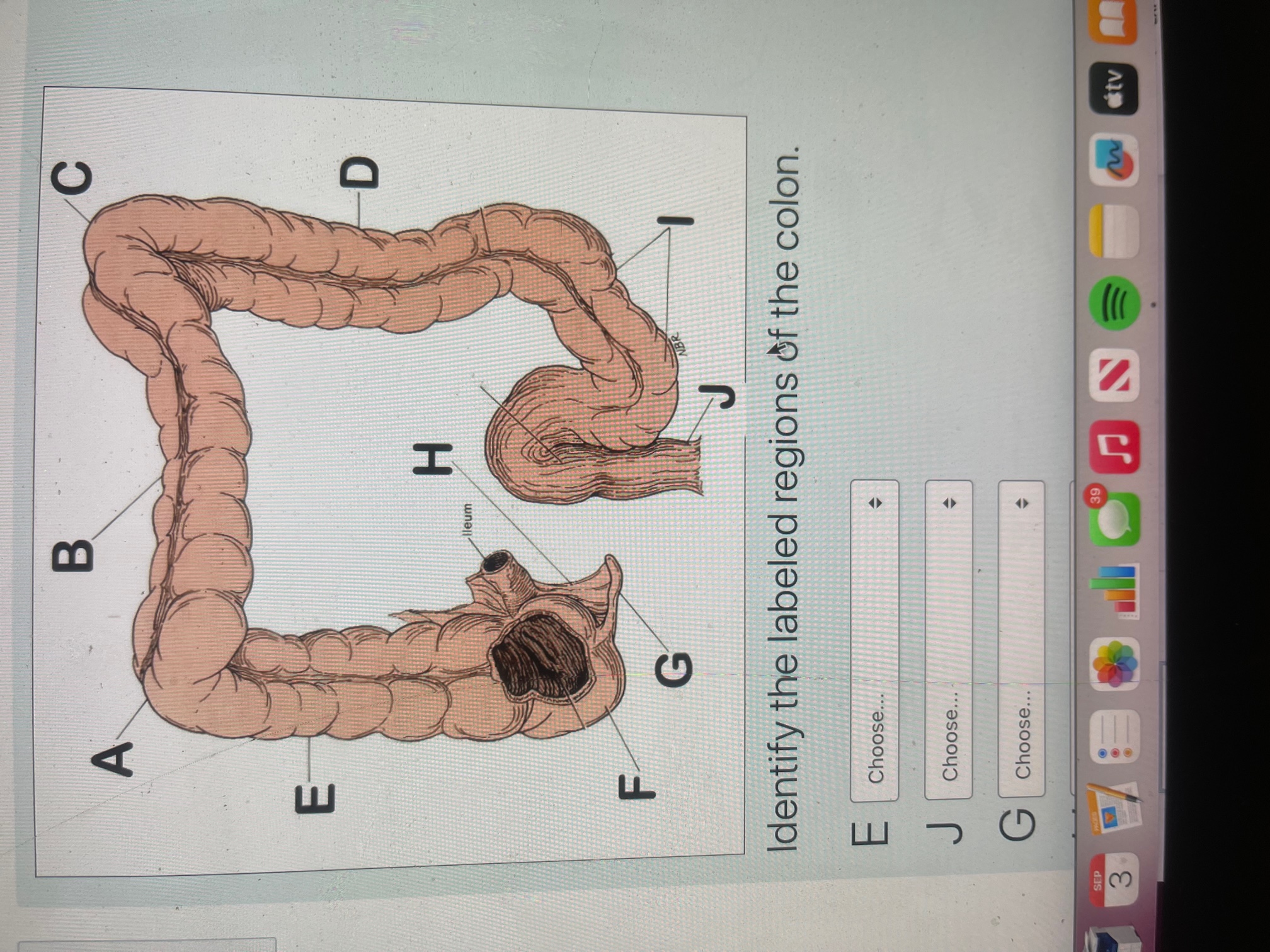 Solved Identify the labeled regions of the colon. EJ | Chegg.com