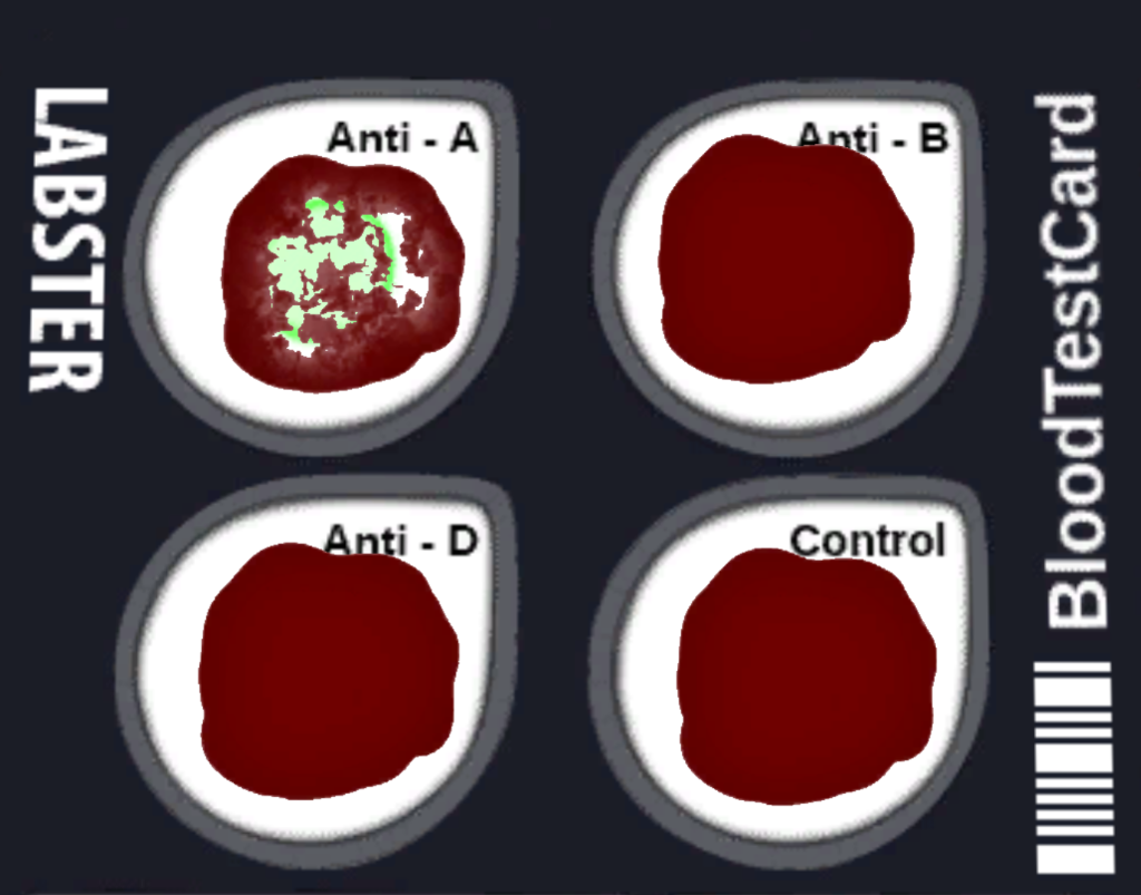 Solved I got this wrong can someone help me? Label the blood