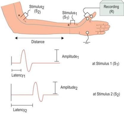 Solved Calculate the motor conduction velocity for the | Chegg.com