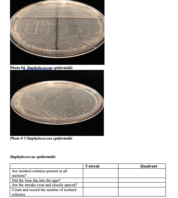 staphylococcus epidermidis streak plate