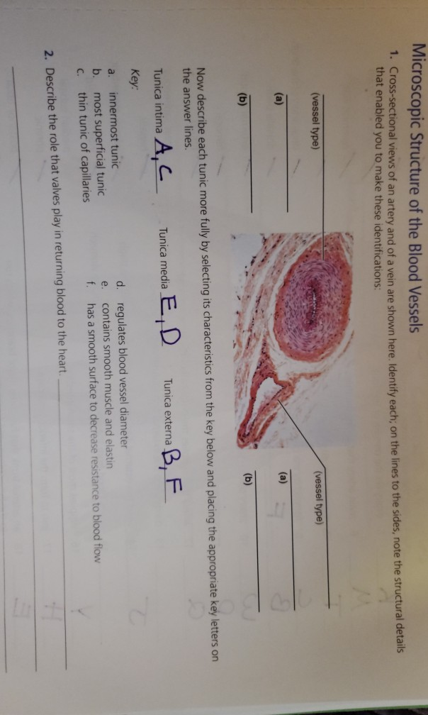 solved-microscopic-structure-of-the-blood-vessels-chegg