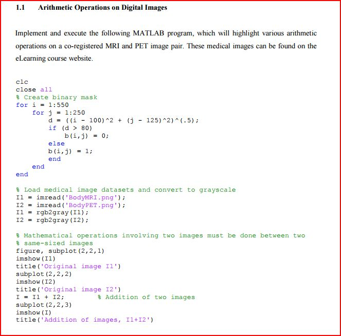 Help me code the MATLAB script fot exercise below. ( | Chegg.com