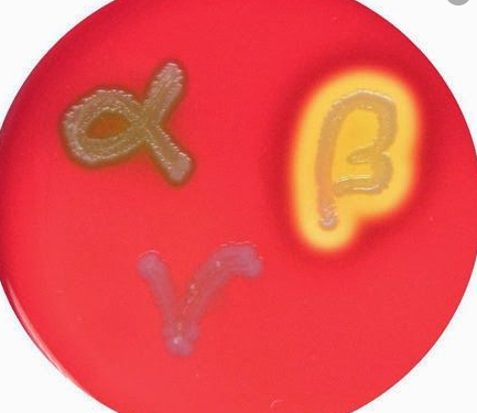 Solved Exercise 17Exercise 17: The Effect of UV Radiation on | Chegg.com