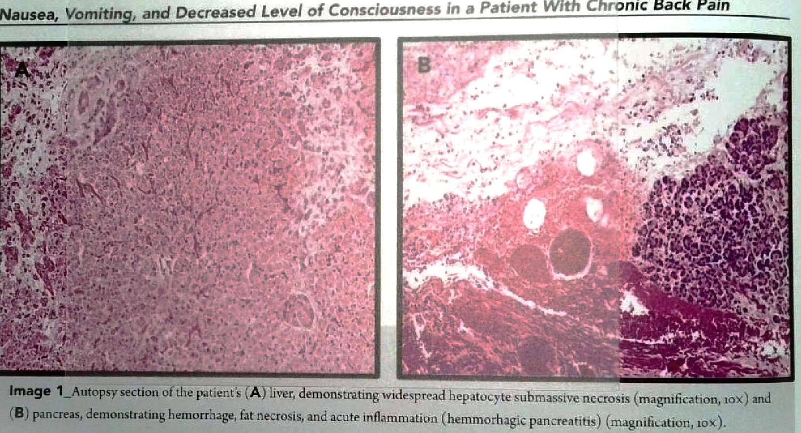 solved-image-1-autopsy-section-of-the-patient-s-a-liver-chegg