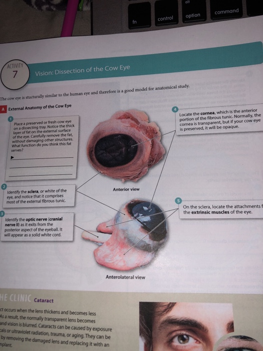 Solved alt command fn control option ACTIVITY Vision