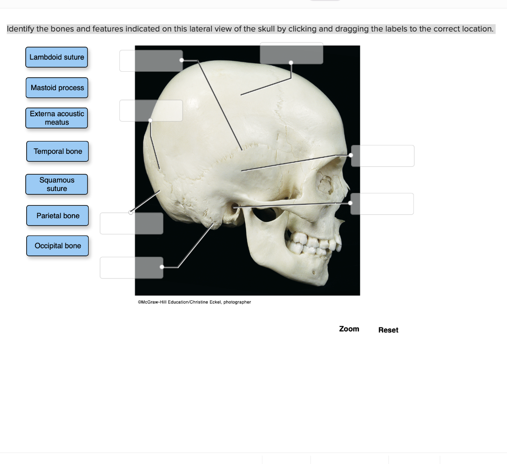 Solved Identify The Bones And Features Indicated On This | Chegg.com