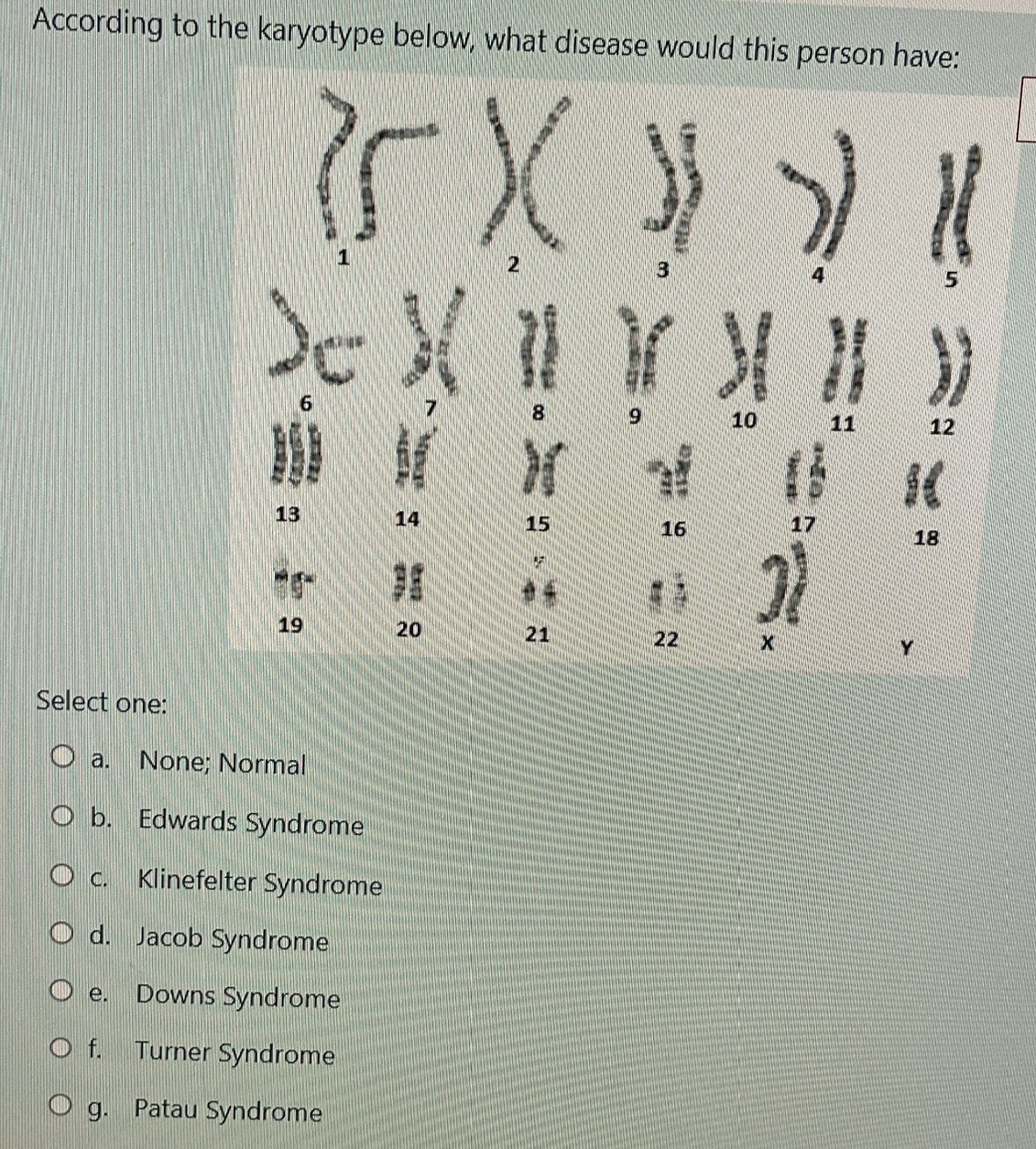 Solved According to the karyotype below, what disease would | Chegg.com