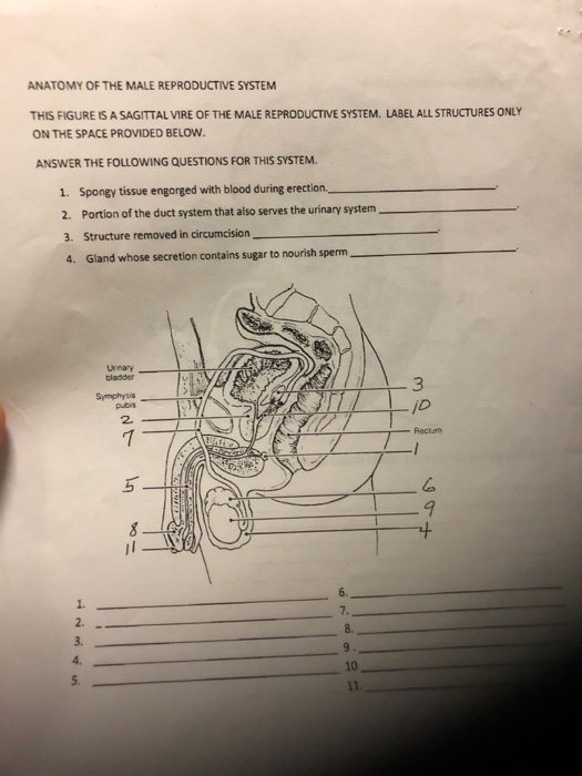 Solved GE INTESTINE PARTS (ANTERIOR VIEW) IGURE LARGE E THE | Chegg.com