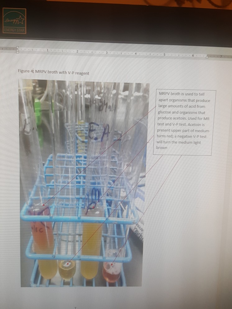 Solved Lab 14 Fermentation PURPOSE This lab was to