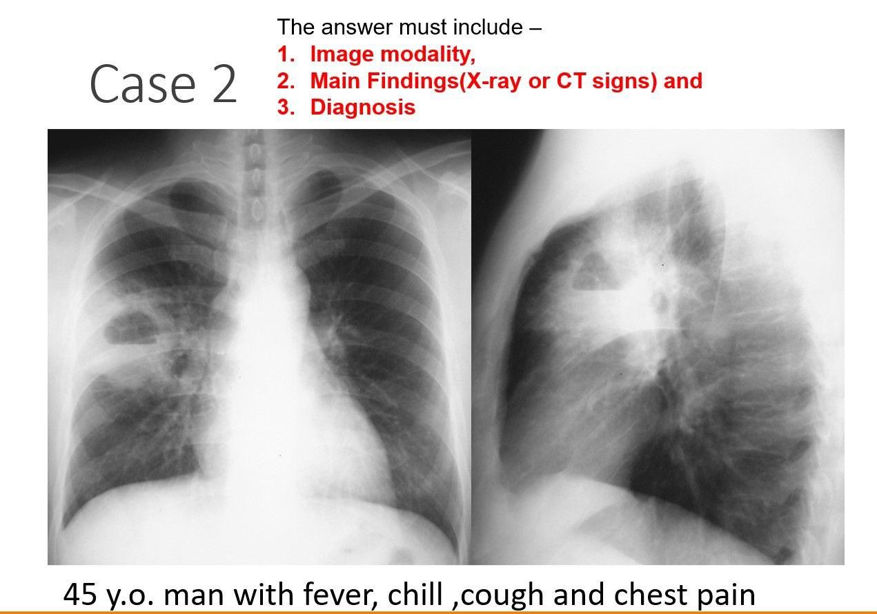 Solved The answer must include - 1. Image modality, 2. Main | Chegg.com