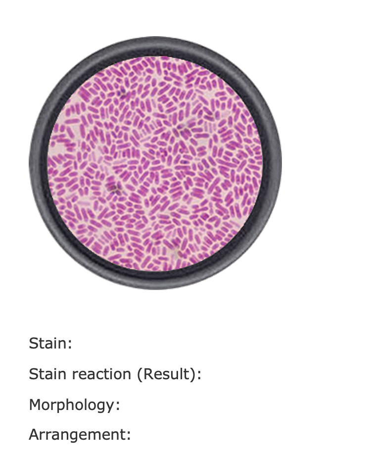 Solved 6. Describe the microscopic image seen belbw using | Chegg.com