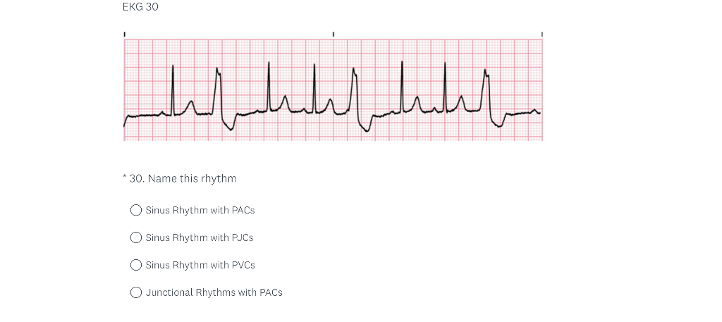 Solved Use The EKG Strips To Answer The Questions Below Each | Chegg.com